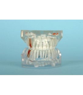 MODELE DENTITION PEDO+OCLUSION TRANSPARENT