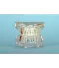 MODELE DENTITION PEDO+OCLUSION TRANSPARENT